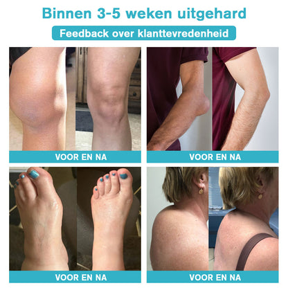 Raindew™ Nerve Relief Lotion (🔥kortingen duren 30 minuten 🔥）