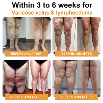 DiSyan™ Ultrasoon Vetverbrandend Ver Infrarood Bloedsuiker Balancerend Detox Polsbandje