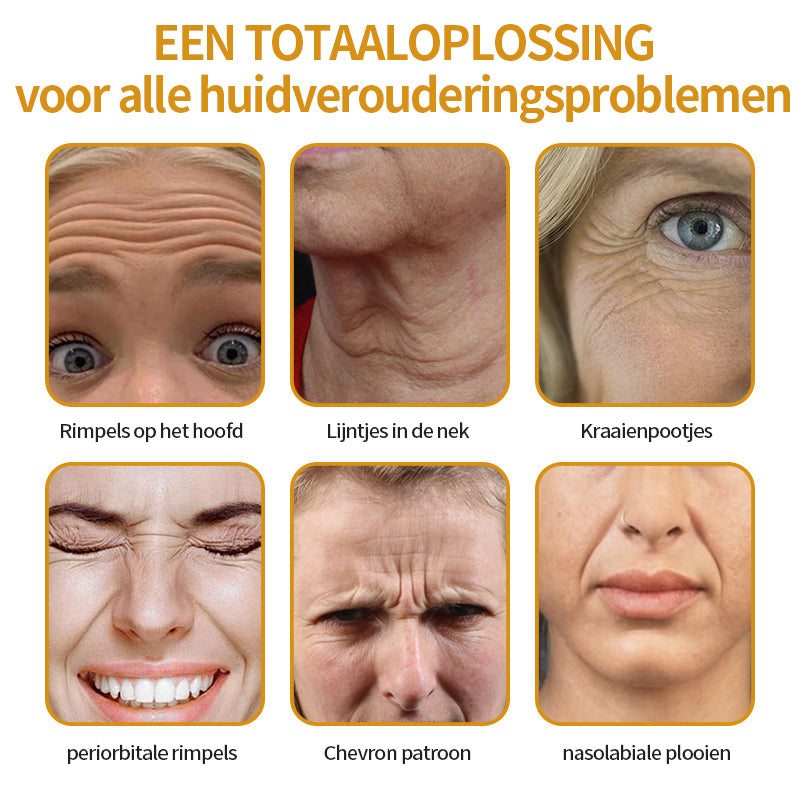 Laatste dag van de promotie: 70% korting op -Coolord™ Botox Bee Venom Wrinkle Removal Cream