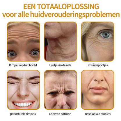 Laatste dag van de promotie: 70% korting op -Coolord™ Botox Bee Venom Wrinkle Removal Cream