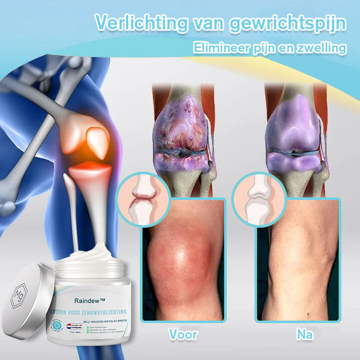 Raindew™ Nerve Relief Lotion (🔥kortingen duren 30 minuten 🔥）