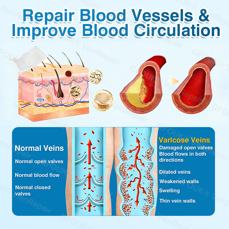 🇨🇦🏆🏃‍♀️GFOUK® VeinRepair Microneedle Patch Roll⚡Instant Relief, Long-Term Results
