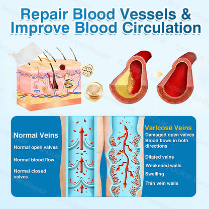 🇨🇦🏆🏃‍♀️GFOUK® VeinRepair Microneedle Patch Roll⚡Instant Relief, Long-Term Results