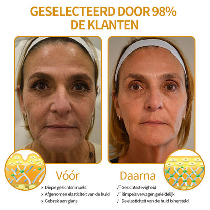 Laatste dag van de promotie: 70% korting op -Coolord™ Botox Bee Venom Wrinkle Removal Cream