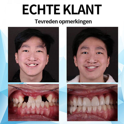 Mresio™ Silicone Gevoerde Prothese Kit (👩‍🔬 aanbevolen door tandarts)