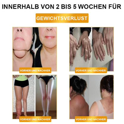 DiSyan™ Ultrasoon Vetverbrandend Ver Infrarood Bloedsuiker Balancerend Detox Polsbandje