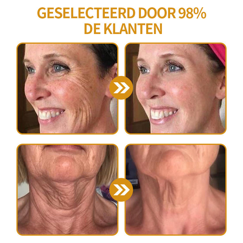 Laatste dag van de promotie: 70% korting op -Coolord™ Botox Bee Venom Wrinkle Removal Cream