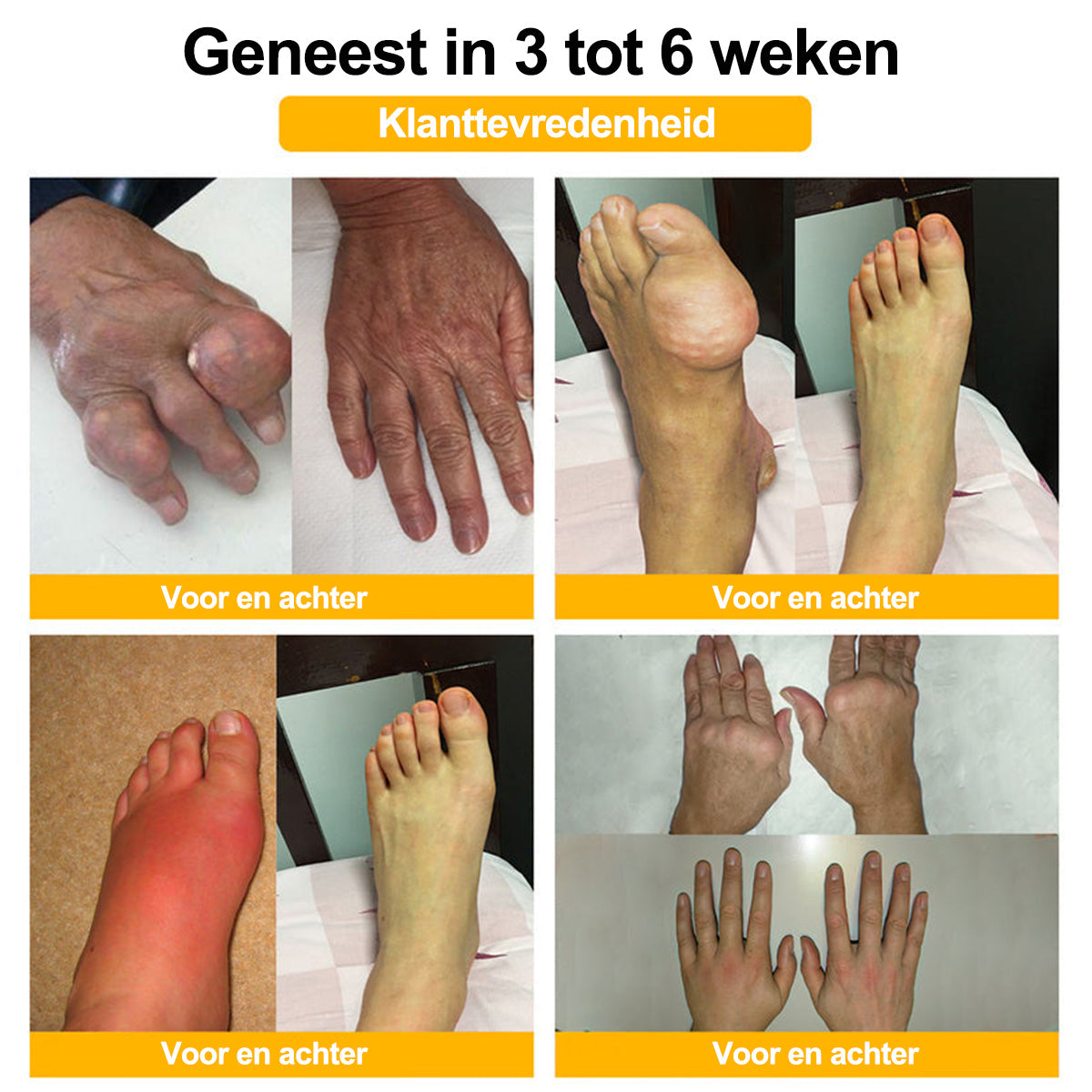 Raindew® Botuline Toxine & Bijengif Pijnstillende Crème voor botgenezing