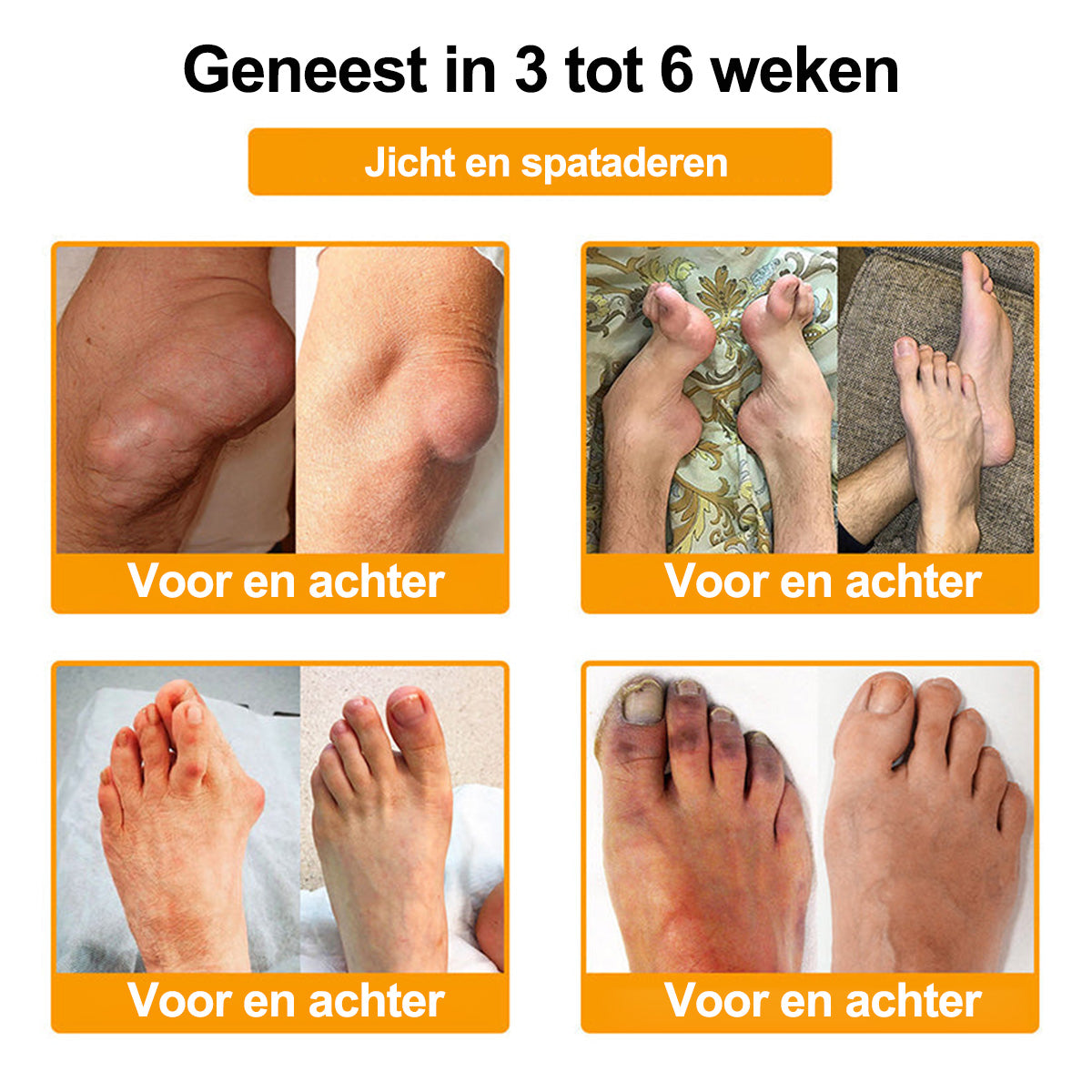Raindew® Botuline Toxine & Bijengif Pijnstillende Crème voor botgenezing