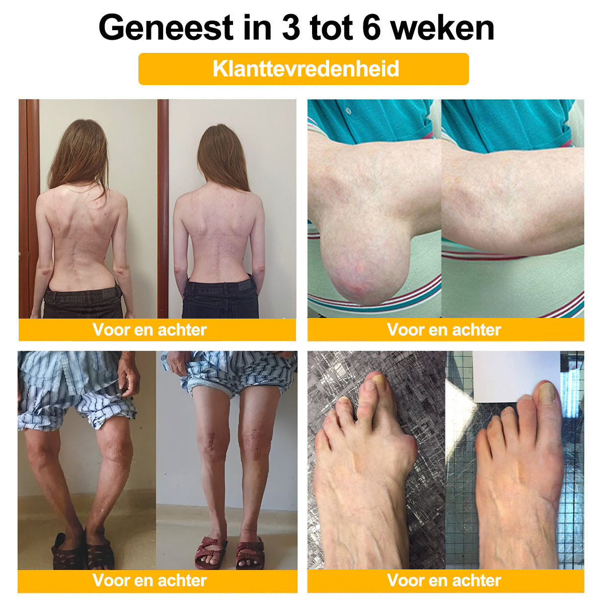 Raindew® Botuline Toxine & Bijengif Pijnstillende Crème voor botgenezing
