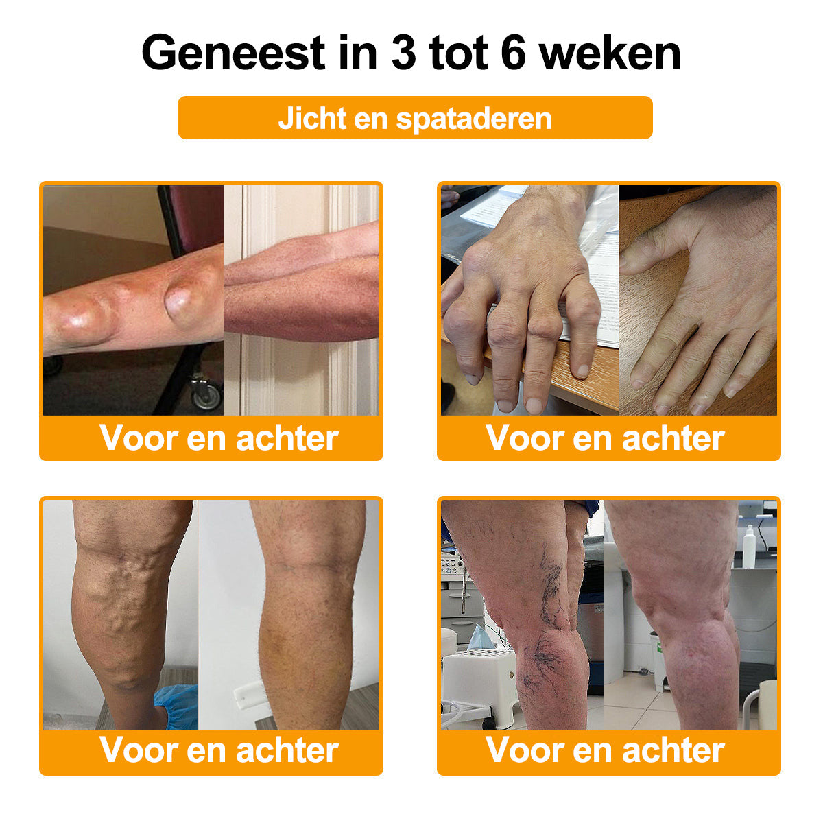 Raindew® Botuline Toxine & Bijengif Pijnstillende Crème voor botgenezing