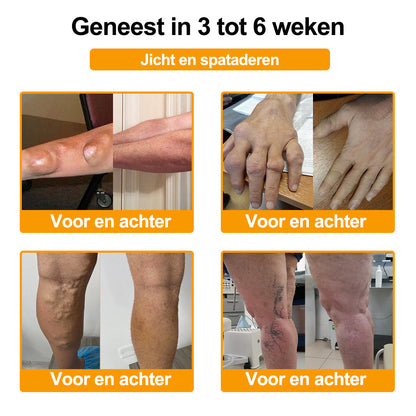 Raindew® Botuline Toxine & Bijengif Pijnstillende Crème voor botgenezing