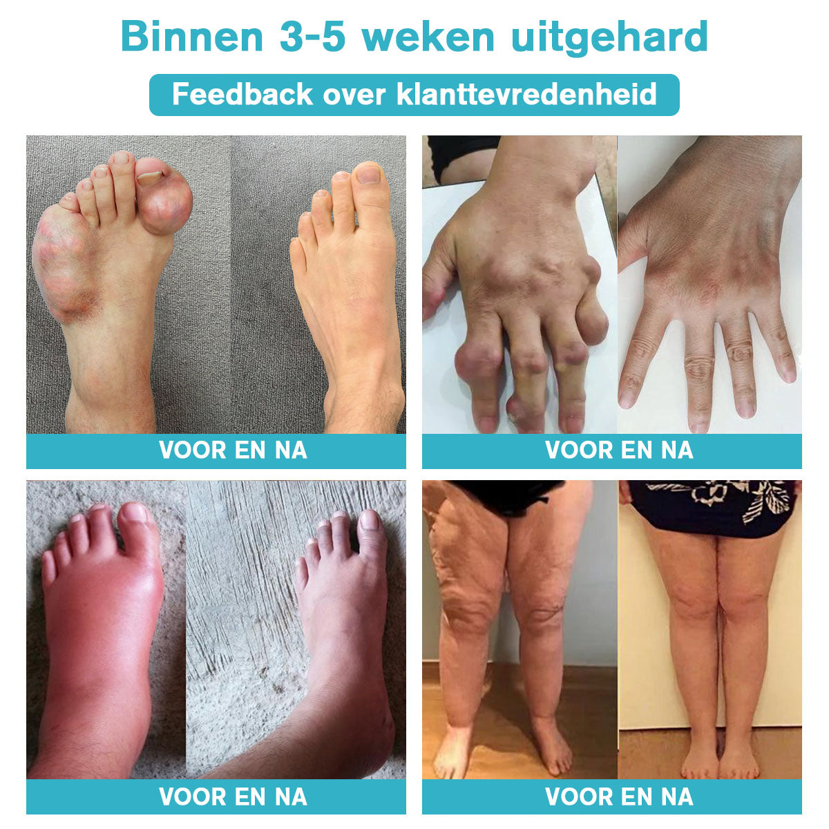 Raindew™ Nerve Relief Lotion (🔥kortingen duren 30 minuten 🔥）