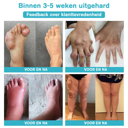 Raindew™ Nerve Relief Lotion (🔥kortingen duren 30 minuten 🔥）