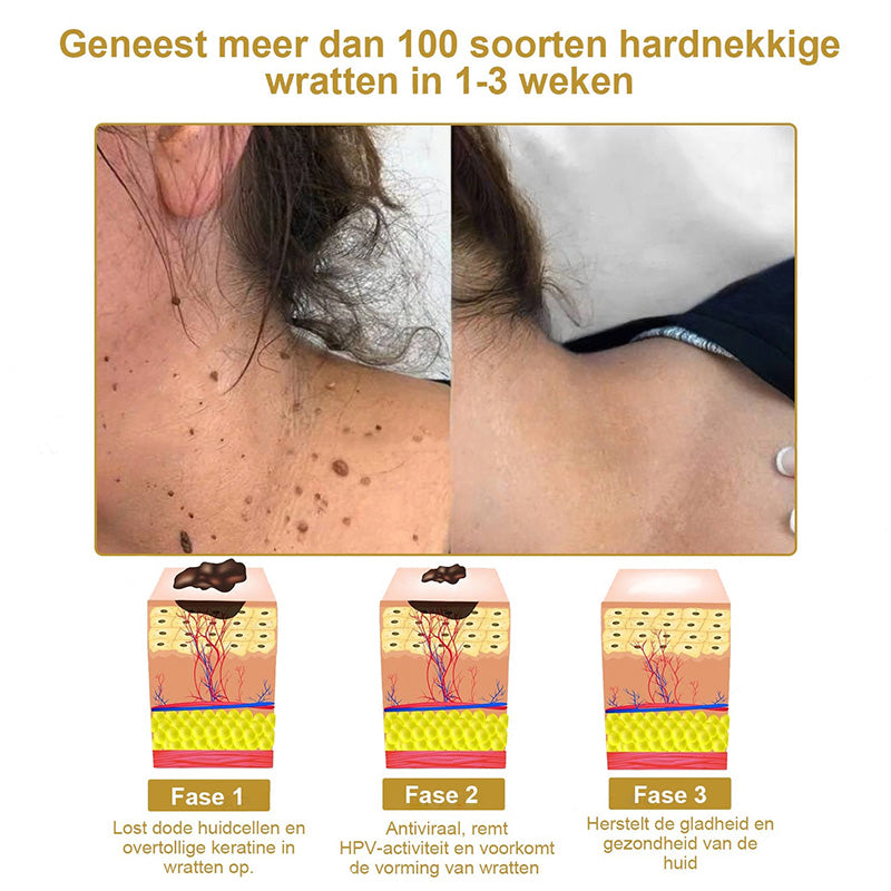 Raindew™ 𝐄𝐟𝐟𝐞𝐜𝐭𝐢𝐞𝐯𝐞 𝐀𝐥𝐥𝐞𝐬-𝐢𝐧-éé𝐧 𝐇𝐮𝐢𝐝𝐛𝐞𝐡𝐚𝐧𝐝𝐞𝐥𝐢𝐧𝐠𝐬𝐜𝐫è𝐦𝐞