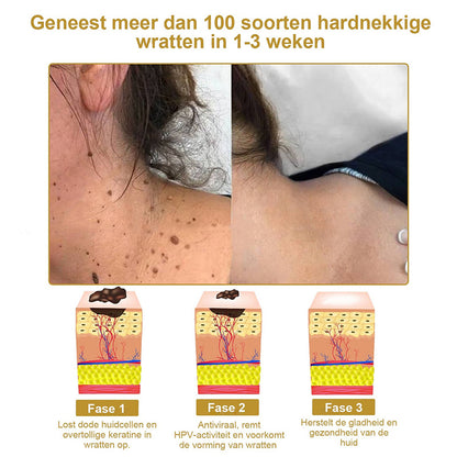 Raindew™ 𝐄𝐟𝐟𝐞𝐜𝐭𝐢𝐞𝐯𝐞 𝐀𝐥𝐥𝐞𝐬-𝐢𝐧-éé𝐧 𝐇𝐮𝐢𝐝𝐛𝐞𝐡𝐚𝐧𝐝𝐞𝐥𝐢𝐧𝐠𝐬𝐜𝐫è𝐦𝐞