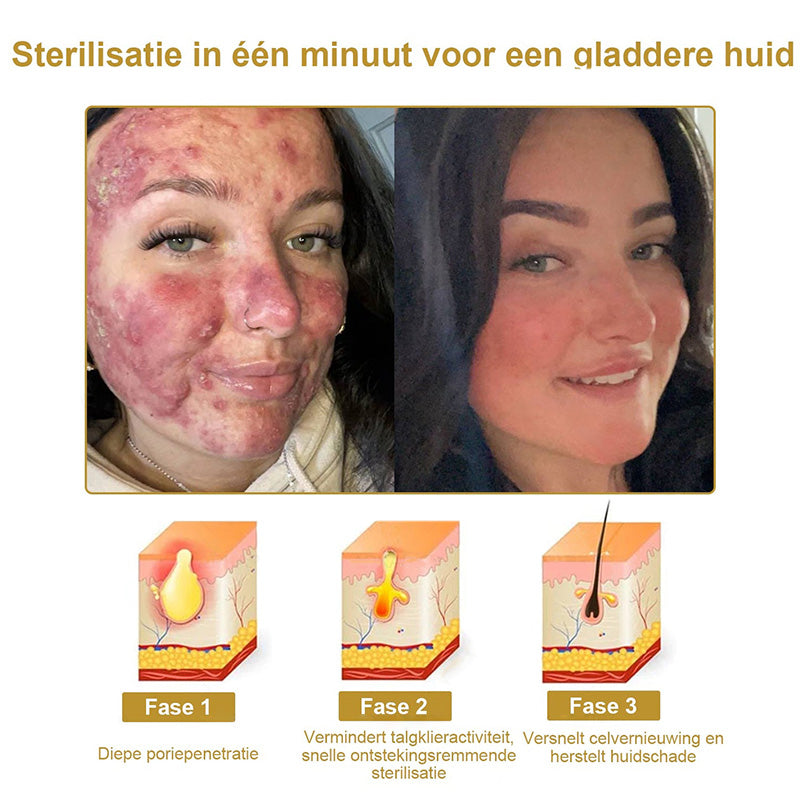 Raindew™ 𝐄𝐟𝐟𝐞𝐜𝐭𝐢𝐞𝐯𝐞 𝐀𝐥𝐥𝐞𝐬-𝐢𝐧-éé𝐧 𝐇𝐮𝐢𝐝𝐛𝐞𝐡𝐚𝐧𝐝𝐞𝐥𝐢𝐧𝐠𝐬𝐜𝐫è𝐦𝐞