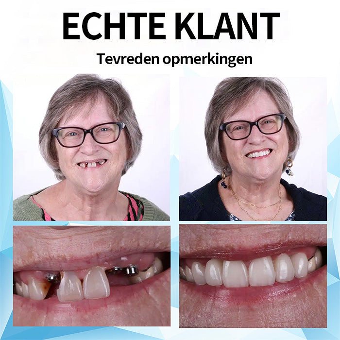 Mresio™ Silicone Gevoerde Prothese Kit (👩‍🔬 aanbevolen door tandarts)