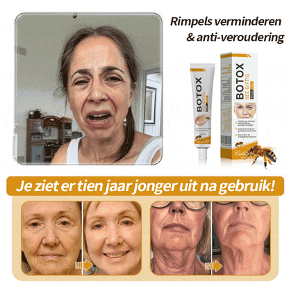 Laatste dag van de promotie: 70% korting op -Coolord™ Botox Bee Venom Wrinkle Removal Cream